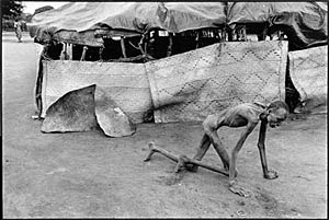 Starvation in Sudan; photo by James Nachtwey