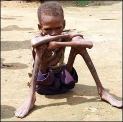 Starving child.